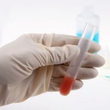 Formation "Autotests de dépistage du VIH en officine – Guide pratique"