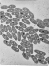 Un biofilm colonisant un filtre de traitement d'eau souterraine