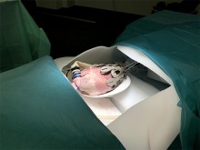 Exosquelette placé sur un cœur porcin explanté et mis en situation dans le simulateur EXOHEART conçu par l'équipe projet Exosquelette placé sur un cœur porcin explanté et mis en situation dans le simulateur EXOHEART conçu par l'équipe projet