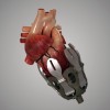 Simulation numérique de l’exosquelette Simulation numérique de l’exosquelette